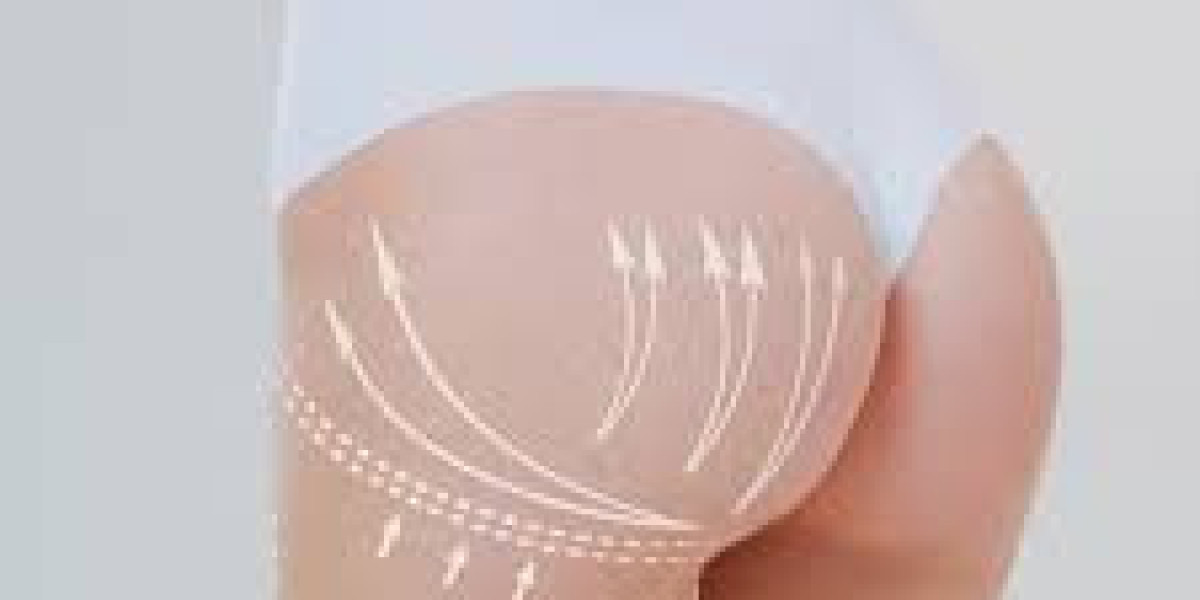Non-Surgical Buttock Lift Options in Dubai for Natural Body Enhancement